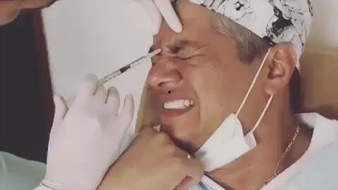 川字纹除皱打法视频,跟随视频学习高效打法